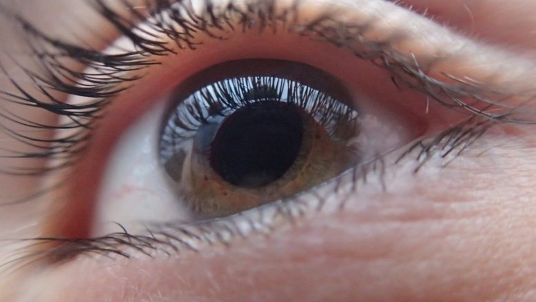 un ojo de primer plano que acentúa las pestañas estrechas, la pupila, el iris y la córnea formando queratocono